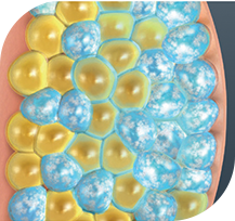 Coolsculpting Procedure - 6