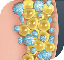 Coolsculpting Procedure - 7