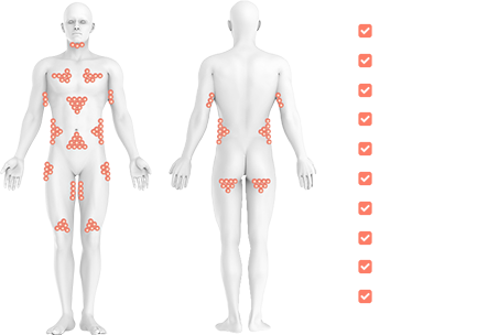 Coolsculpting Procedure - 3